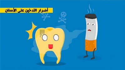 أضرار التدخين على الأسنان