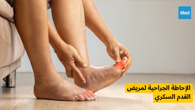 الإحاطة الجراحية لمريض القدم السكري