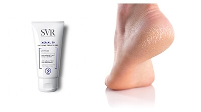 مرض القدم السّكّري و كيفيّة علاجه 