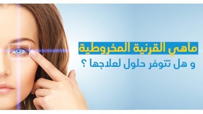 ماهي القرنيّة المخروطيّة و هل تتوفّر حلول لعلاجها ؟ 