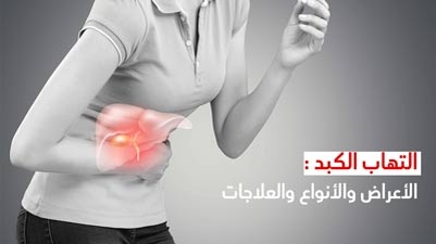 التهاب الكبد :الأعراض والأنواع والعلاجات