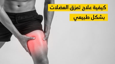 كيفية علاج تمزق العضلات بشكل طبيعي