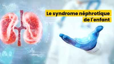 le syndrome néphrotique de l