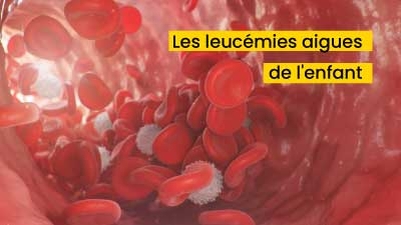 Les leucémies aigues de l