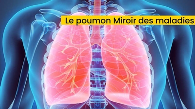Le poumon Miroir des maladies
