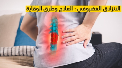 الانزلاق الغضروفي : العلاج وطرق الوقاية
