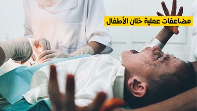 مضاعفات عملية ختان الأطفال