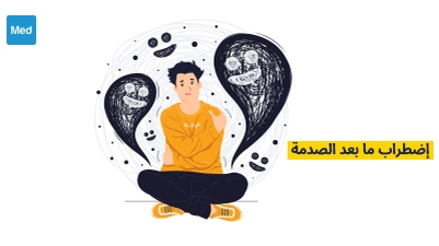 اضطراب ما بعد الصدمة