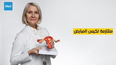 متلازمة تكيس المبايض : الأعراض والأسباب والعلاج