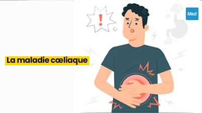 Maladie cœliaque : définition, causes, symptômes et traitement