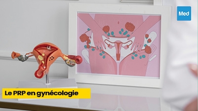 Le PRP en gynécologie : une nouvelle approche thérapeutique