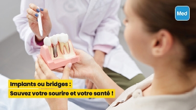  Implants ou bridges : Sauvez votre sourire et votre santé !