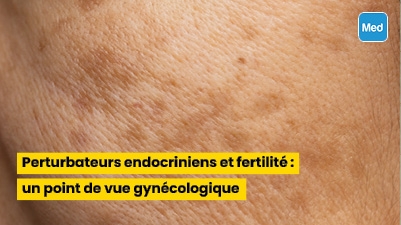 Taches brunes et mélasma : causes, symptômes et traitements