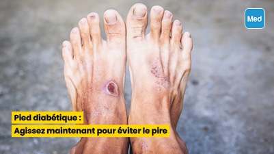 Pied diabétique : Agissez maintenant pour éviter le pire