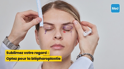 Sublimez votre regard : Optez pour la blépharoplastie