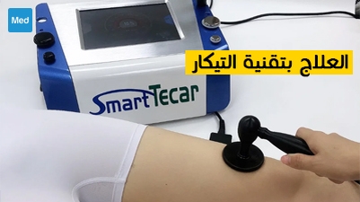 العلاج بتقنية التيكار 