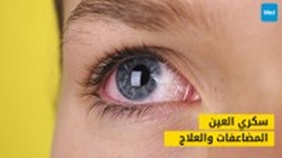 سكري العين: دليلك الشامل لفهم المضاعفات والعلاج