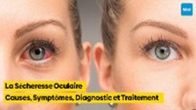 La Sécheresse Oculaire : Causes, Symptômes, Diagnostic et Traitement