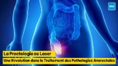 La Proctologie au Laser : Une Révolution dans le Traitement des Pathologies Anorectales