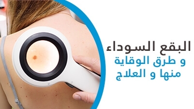 البقع السوداء و طرق الوقاية منها و العلاج
